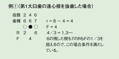 例①（第1大臼歯の遠心根を抜歯した場合）